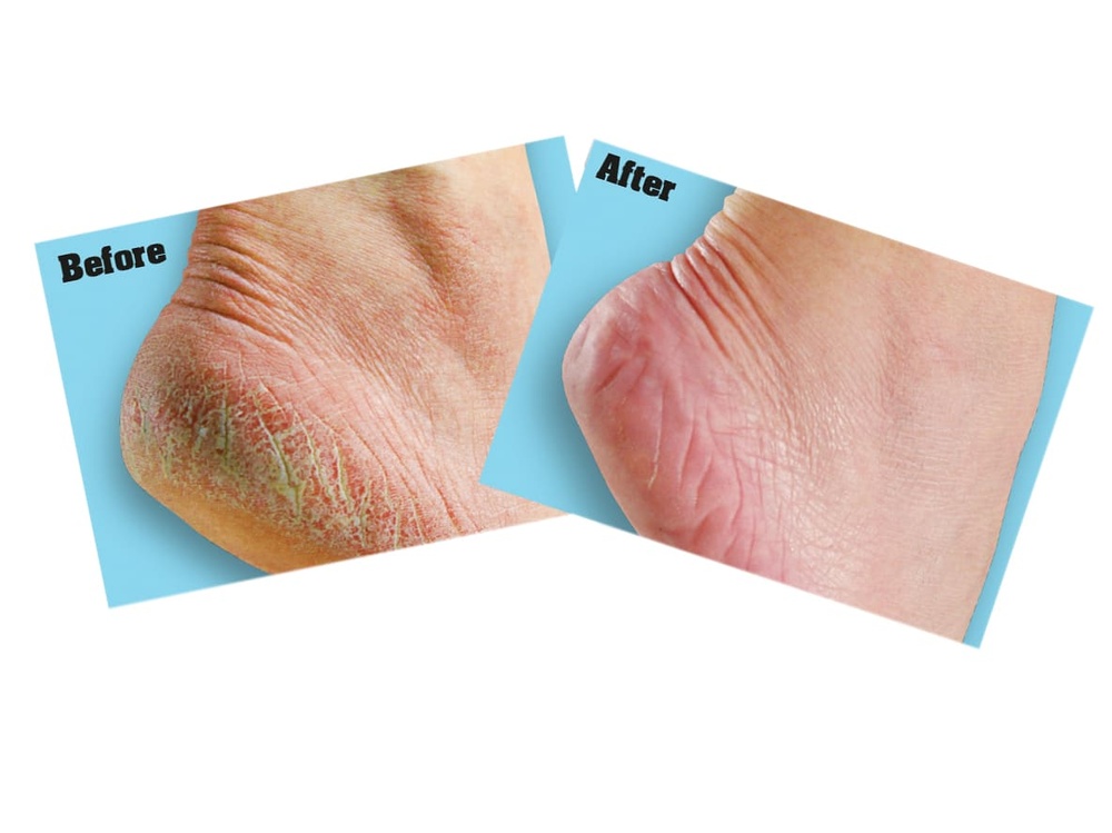 O'Keeffe's Healthy Feet Foot Cream 91g Jar